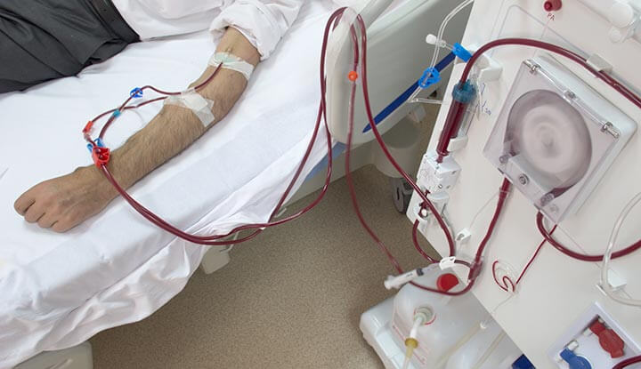 woman having dialysis